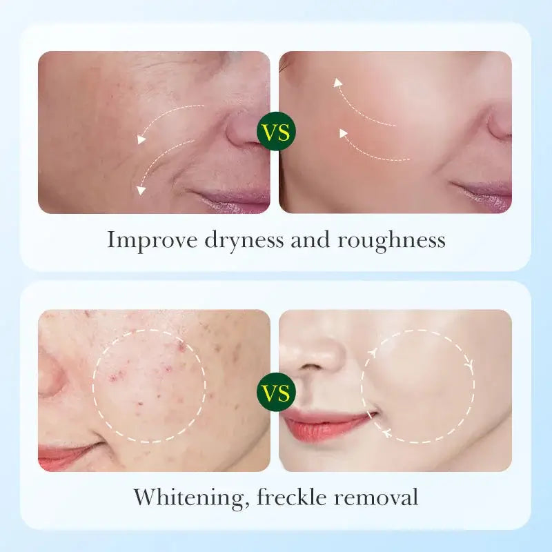 Whitening Skin Care Set (Original)